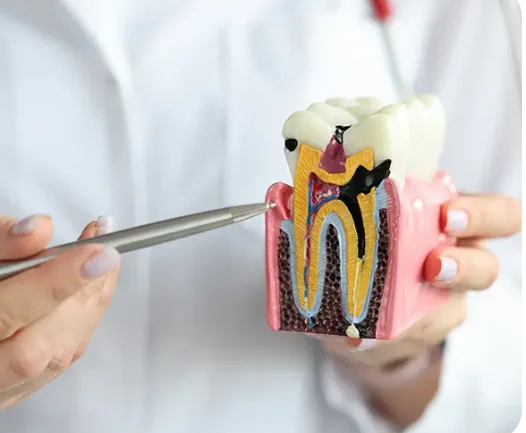 Endodoncia Odonto Ávila Caracas